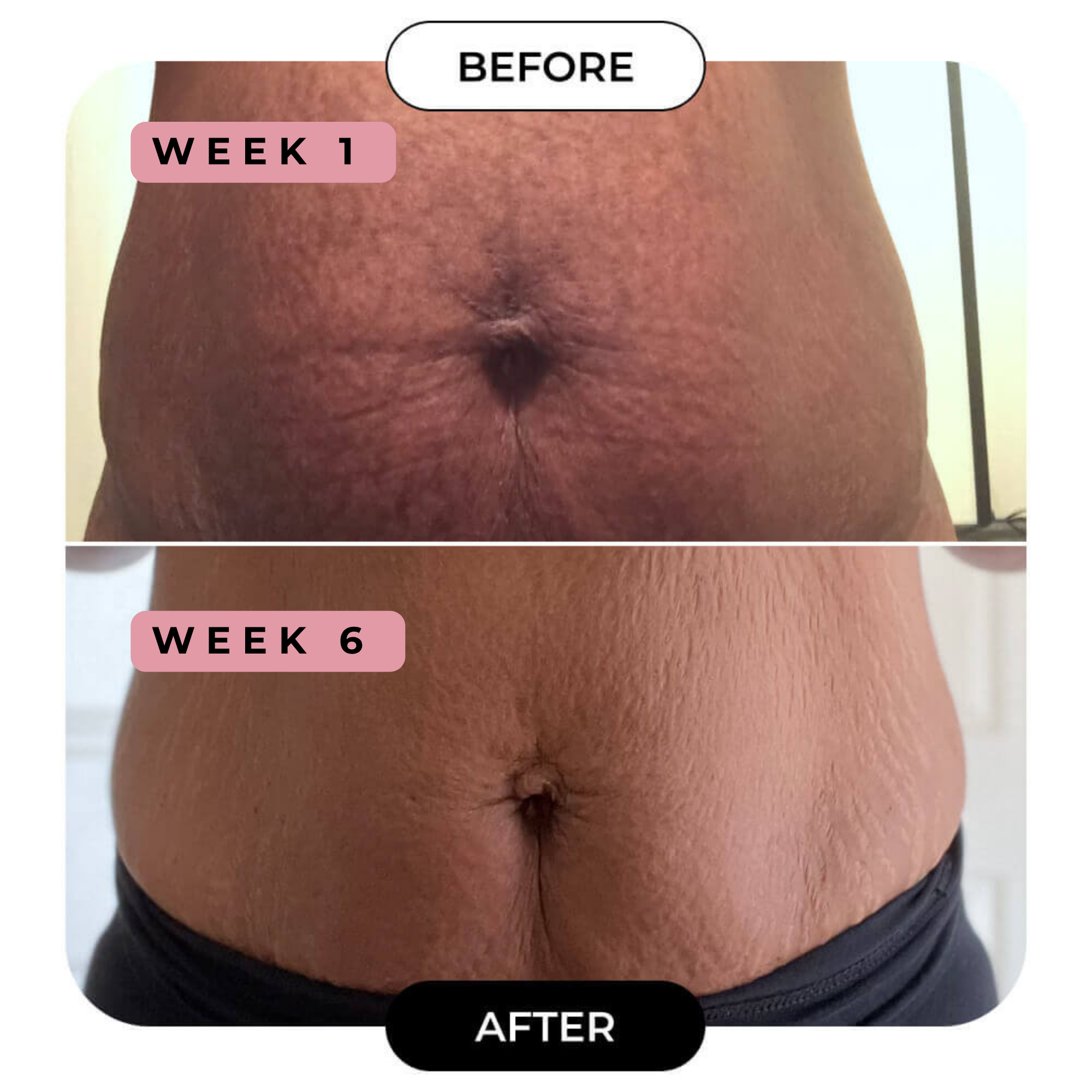 B-FLAT Belly Firming Cream