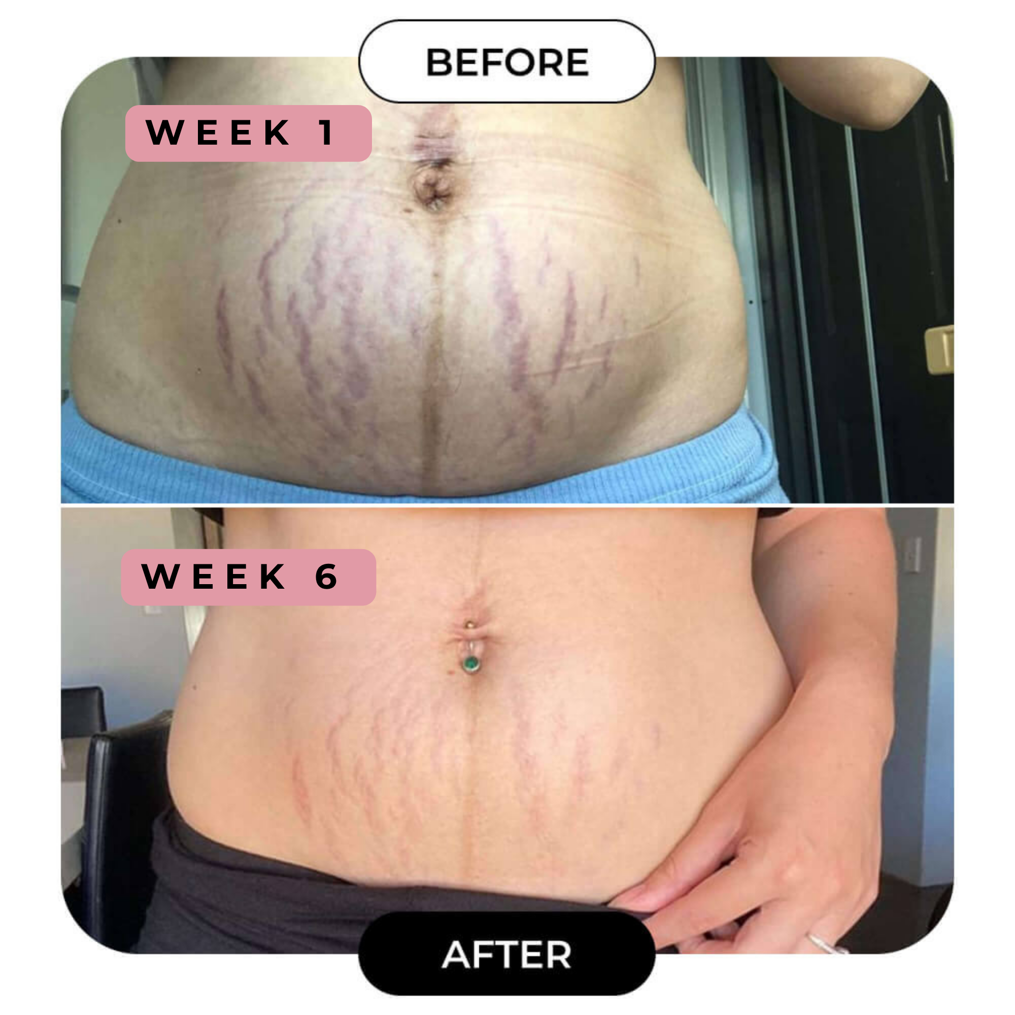 B-FLAT Belly Firming Cream