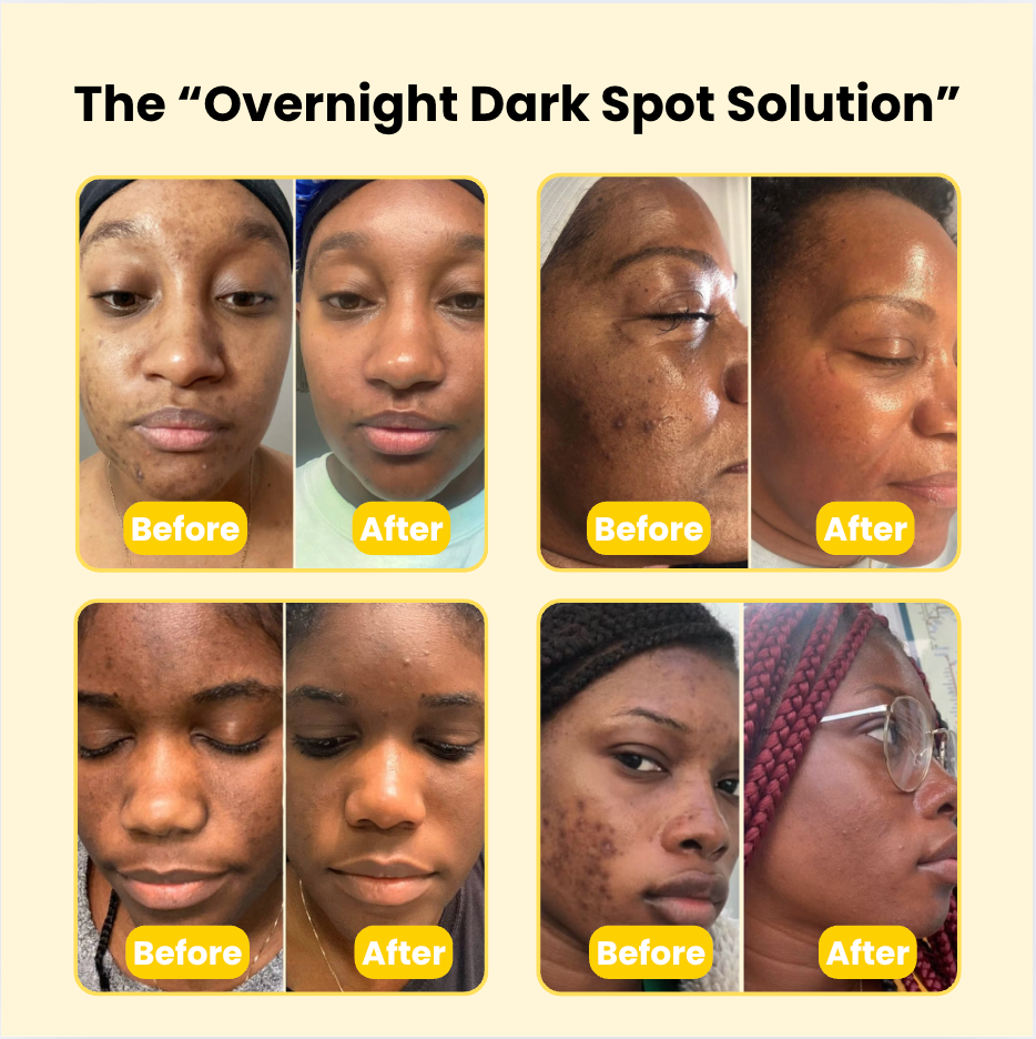 Kojic Acid Turmeric Overnight Wrapping Mask
