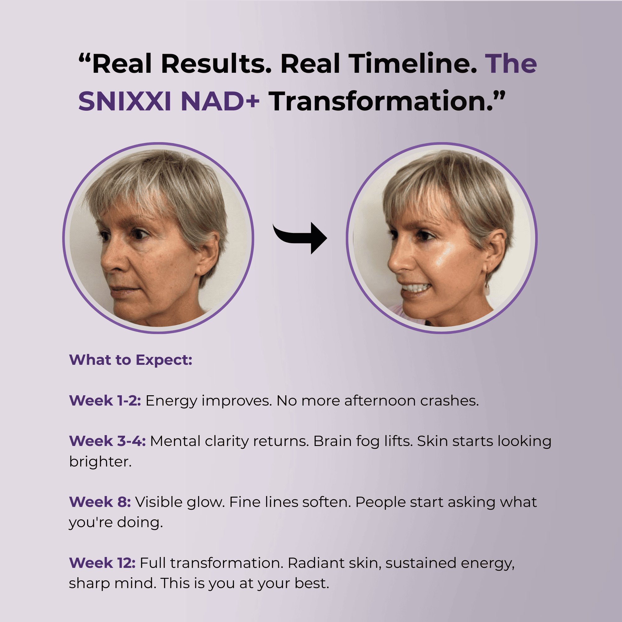 Snixxi. Liposomal NAD+